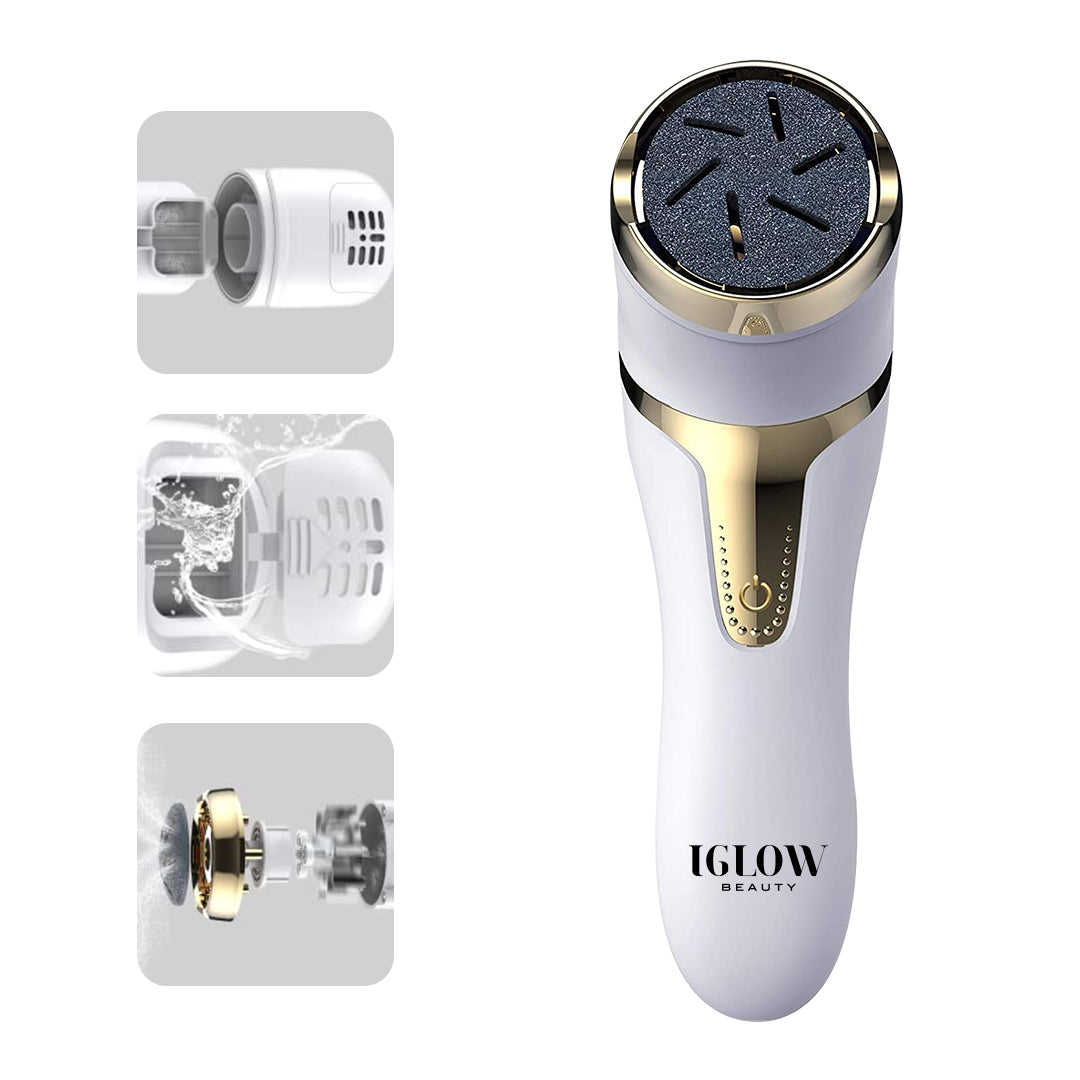 Iglow Foot Smoother - Callus Remover